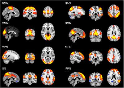 Education differentiates cognitive performance and resting state fMRI connectivity in healthy aging